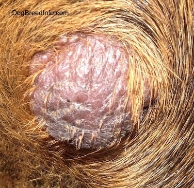  Wart Pictures on Cancerous Mast Cell Tumor Above The Skin