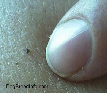   Breed Pictures on Tick Pictures And Photos  Ticks On Dogs  Ticks On Humans