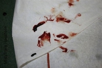 Blood on a paper towel