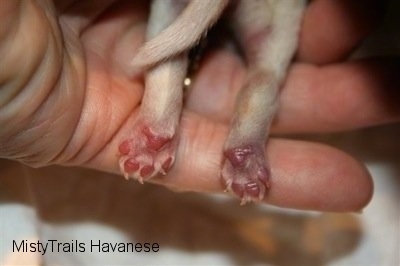 Close Up - One discolored foot and a normal foot