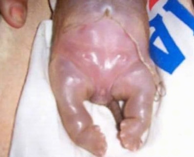 the bottom end of a water puppy born in Khayelitsha, South Africa