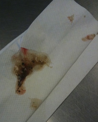 Brown, red and black fluid drained from the infected anal gland on a white paper towel