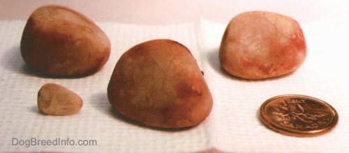 Four Kidney Stones on a tissue next to a Canadian coin for size comparisons