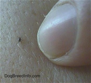 Close up - A persons pointing at a tiny tick on there arm.
